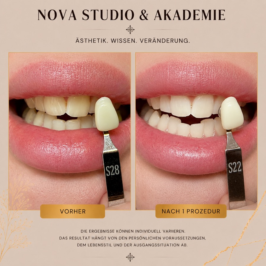 Vorher / Nachher · Nova Studio